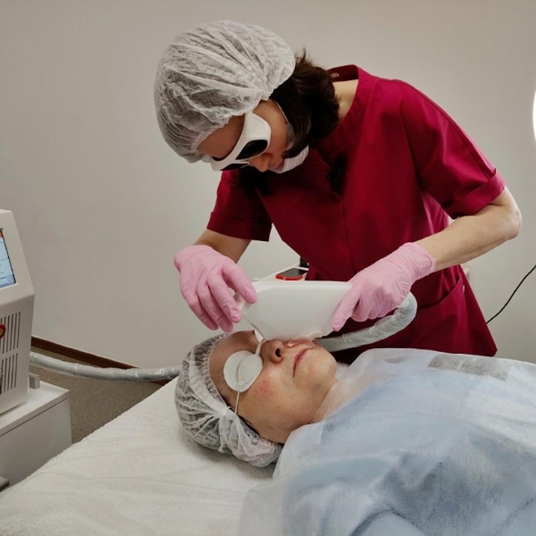 Омоложение кожи лица на аппарате capello