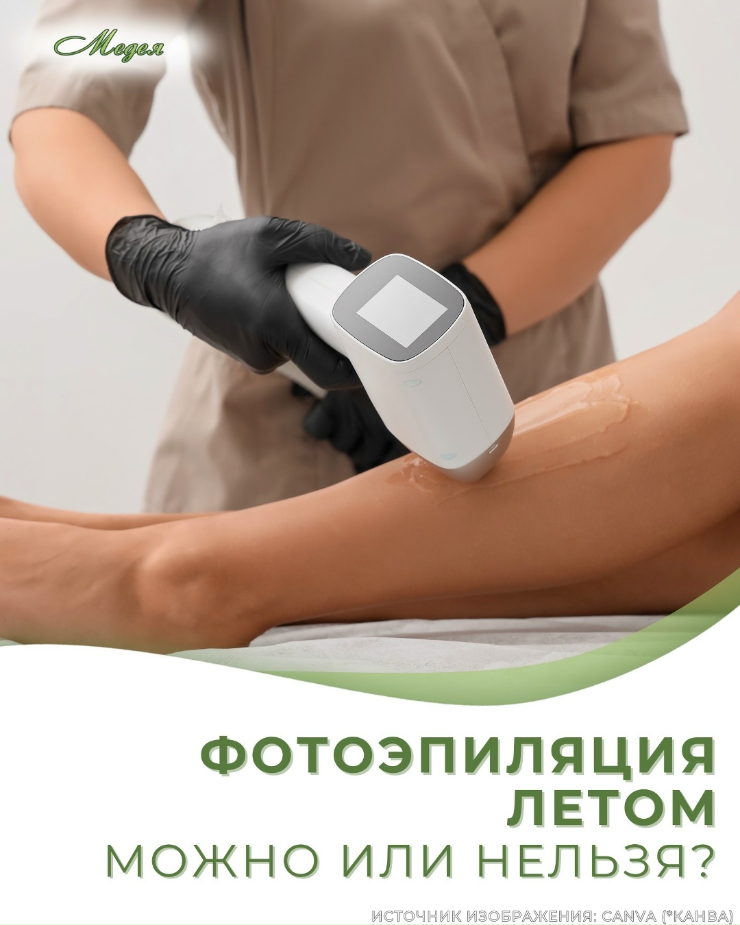 Фотоэпиляция летом